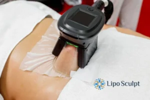 Does Fat Freezing At Home Work? 3 Fat freezing at home from Lipo Sculpt Hucknall under Huthwaite